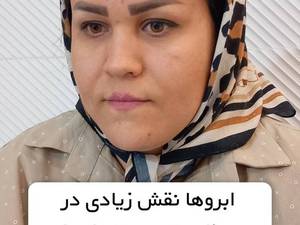 چگونگی کاشت تخصصی ابرو در تهران
