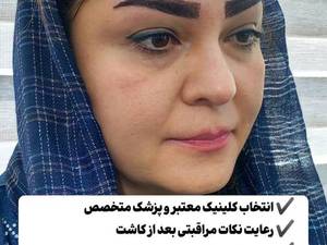 نمونه هایی از کاشت ابرو حرفه ای
