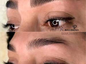  فیبروز ابرو در تبریز