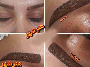 انجام میکروبلیدینگ ابرو