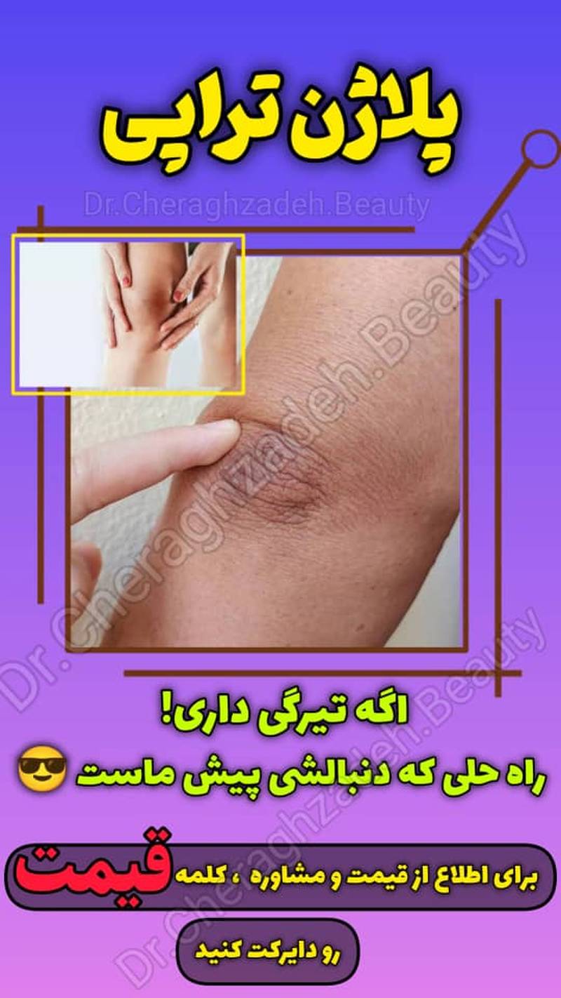 پلاژن تراپی در رشت