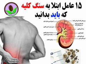 15 عامل ابتلاع به سنگ کلیه که باید بدانید