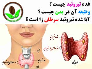 اگر غده تیروئید داری توی بدنت و نمی دونی چیه پس بخون