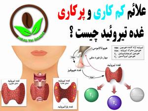 علائم کم کاری و پر کاری تیروئید چیست ؟