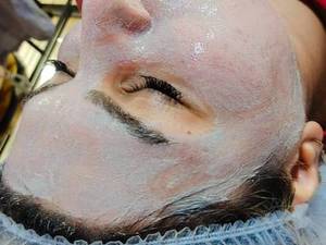 خدمات لیفتینگ و آبرسانی عمیق صورت در اهواز