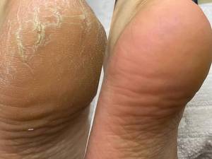 بهترین ناخن کار و پدیکور در کرمانشاه