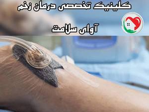 وکیوم تراپی زخم در بابل
