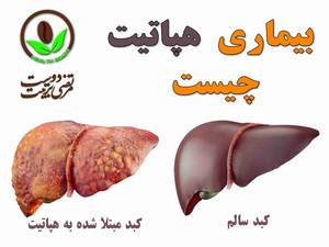 بیماری هپاتیت چیست ؟