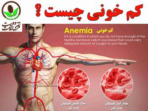 کم خونی چیست ؟