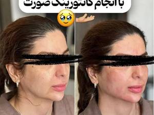 کانتور صورت حرفه‌ای در لاهیجان
