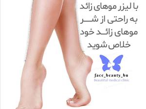 رفع موهای زائد با پیشرفته ترین لیزر روز دنیا