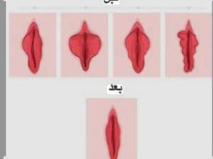 کلینیک تخصصی لابیاپلاستی در خرم‌آباد