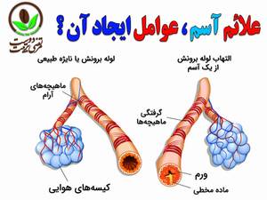 علائم و عوامل ایجاد آسم چیست ؟