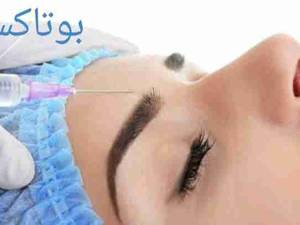 بوتاکس