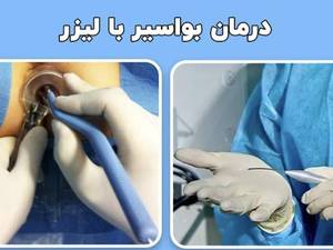 بهترین دکتر برای درمان بواسیر هموروئید در خرم اباد