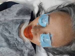 فیشال عمیق برای پاکسازی پوست در کرج