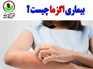 بیماری پوستی اگزما چیست ؟