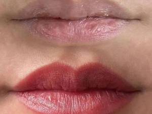 اصلاح فرم و قرینه‌سازی لب با شیدنیگ