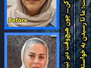 بهترین دکتر تزریق چربی در رشت 