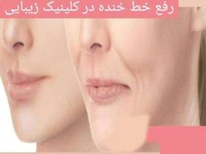 جوانسازی و رفع چین و چروک