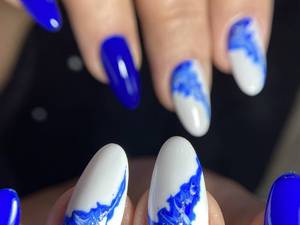 بهترین مرکز تخصصی کاشت و ترمیم ناخن در ساری