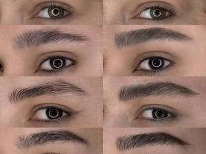 رزرو وقت میکروبلیدینگ و فیبروز در تبریز