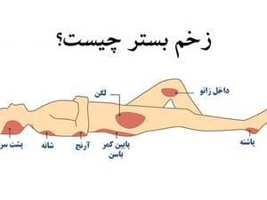 درمان تخصصی زخم بستر در منزل لنگرود