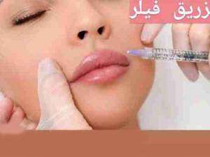 تزریق فیلر لب