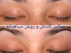 روش مصرف روغن کندش جهت پر پشت نمودن و ترمیم ابرو و مژه