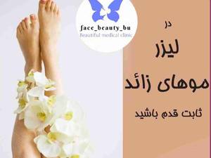 لیزر مو های زاید
