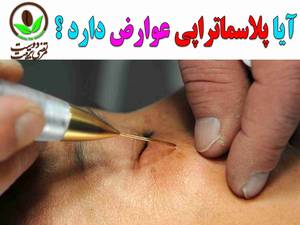 آیا پلاسماتراپی عوارض دارد ؟