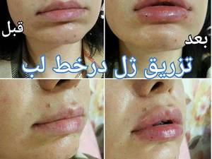 کلینیک زیبایی و تناسب اندام ار‌ژنا