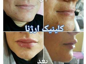 کلینیک زیبایی و تناسب اندام ار‌ژنا