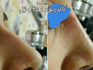 کلینیک زیبایی و تناسب اندام ار‌ژنا