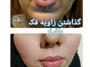 کلینیک زیبایی و تناسب اندام ار‌ژنا