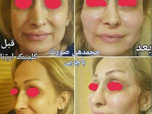 کلینیک زیبایی و تناسب اندام ار‌ژنا