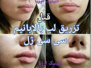 کلینیک زیبایی و تناسب اندام ار‌ژنا
