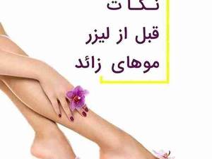 نکات قبل از لیزر موهای زائد