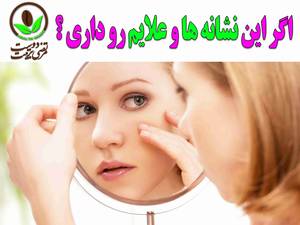 اگر این نشانه ها و علایم جوش صورت رو داری پس ؟