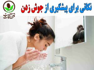 نکاتی برای پیشگیری از جوش زدن ؟