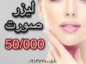 لیزر موهای زائد صورت