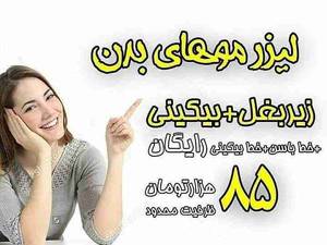 لیزر موهای زائد بدن