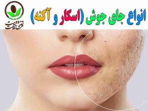می دونی چند نوع جای جوشی داریم ؟