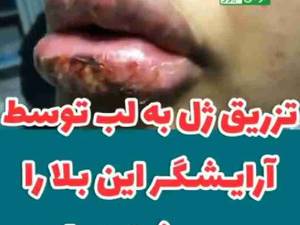 زیبایی خود را فدای ارزانی نکنید