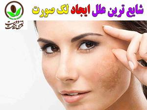 شایع ترین علل ایجاد لک صورت