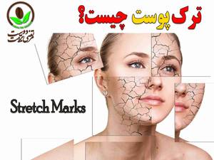 ترک پوستی چیست؟