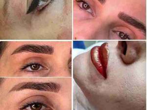 میکروفشن و شیدینگ