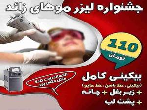 مهم ترین مزایای لیزر در اصفهان