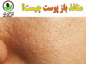 منافذ باز پوست چیست؟