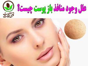علل وجود منافذ باز و بزرگ روی پوست چیست؟